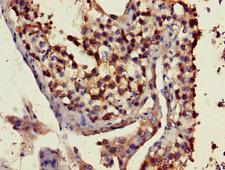 ART3 Antibody - Immunohistochemistry image of paraffin-embedded human testis tissue at a dilution of 1:100