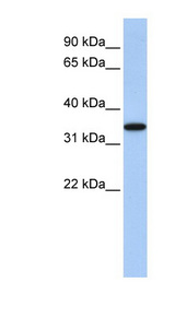 ART4 Antibody - ART4 antibody Western blot of Fetal Heart lysate. This image was taken for the unconjugated form of this product. Other forms have not been tested.