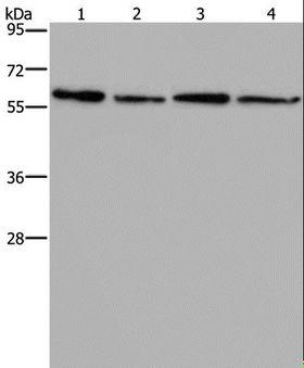 ART4 Antibody - Western blot analysis of Mouse kidney, liver, heart and brain tissue, using ART4 Polyclonal Antibody at dilution of 1:667.
