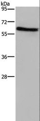 ART4 Antibody - Western blot analysis of Human placenta tissue, using ART4 Polyclonal Antibody at dilution of 1:1000.