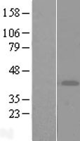 ART4 Protein - Western validation with an anti-DDK antibody * L: Control HEK293 lysate R: Over-expression lysate