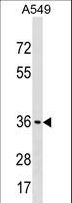 ART5 Antibody - ART5 Antibody western blot of A549 cell line lysates (35 ug/lane). The ART5 antibody detected the ART5 protein (arrow).