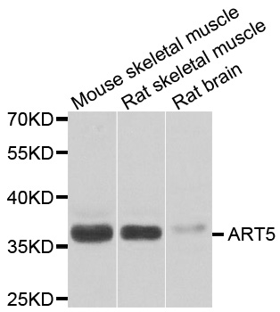 ART5 Antibody - Western blot analysis of extracts of various cell lines.