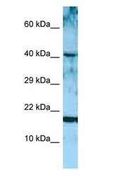ARTN / Artemin Antibody - ARTN / Artemin antibody Western Blot of MCF7.  This image was taken for the unconjugated form of this product. Other forms have not been tested.