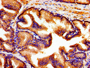ARTN / Artemin Antibody - Immunohistochemistry image of paraffin-embedded human prostate tissue at a dilution of 1:100