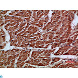 ARTN / Artemin Antibody - Immunohistochemical analysis of paraffin-embedded human-heart, antibody was diluted at 1:200.