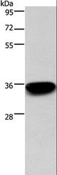 ARTS Antibody - Western blot analysis of 293T cell, using PRPS1/2/1L1 Polyclonal Antibody at dilution of 1:400.