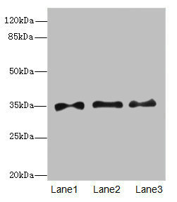 ARTS Antibody - Western blot All Lanes: PRPS1antibody at 6.28ug/ml Lane 1 : HepG-2 whole cell lysate Lane 2 : Jurkat whole cell lysate Lane 3 : 293T whole cell lysate Secondary Goat polyclonal to Rabbit IgG at 1/10000 dilution Predicted band size: 35,28 kDa Observed band size: 35 kDa