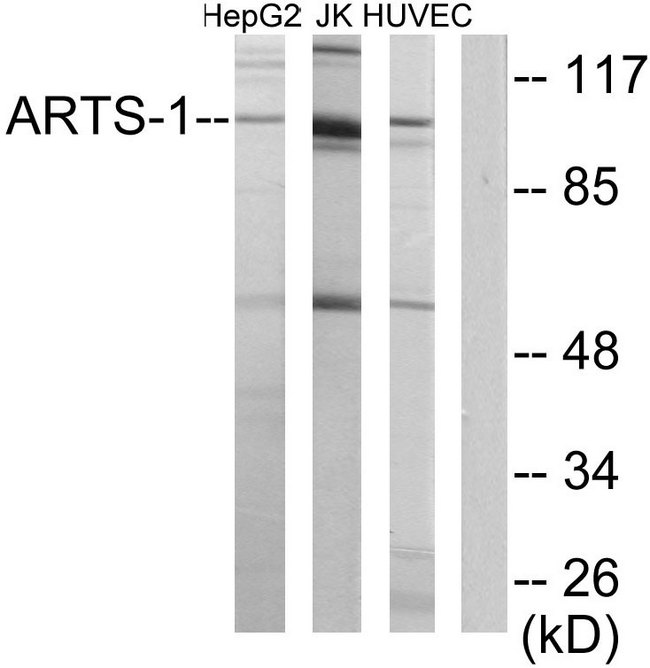 ARTS1 / ERAP1 Antibody - Western blot analysis of lysates from HepG2, Jurkat, and HUVEC cells, using ARTS-1 Antibody. The lane on the right is blocked with the synthesized peptide.
