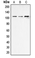 ARTS1 / ERAP1 Antibody - Western blot analysis of ERAP1 expression in THP1 (A); NIH3T3 (B); rat kidney (C) whole cell lysates.