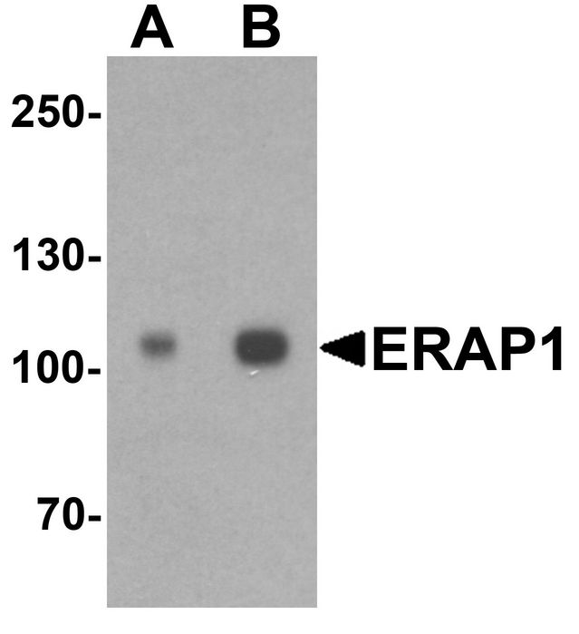 ARTS1 / ERAP1 Antibody - Western blot analysis of ERAP1 in SK-N-SH cell lysate with ERAP1 antibody at (A) 1 and (B) 2 ug/ml.