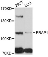 ARTS1 / ERAP1 Antibody - Western blot analysis of extracts of various cell lines.