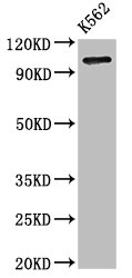 ARTS1 / ERAP1 Antibody - Western Blot Positive WB detected in: K562 whole cell lysate All lanes: ERAP1 antibody at 3.2µg/ml Secondary Goat polyclonal to rabbit IgG at 1/50000 dilution Predicted band size: 108 kDa Observed band size: 108 kDa