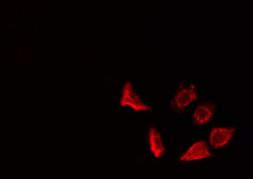 ARTS1 / ERAP1 Antibody - Staining HepG2 cells by IF/ICC. The samples were fixed with PFA and permeabilized in 0.1% Triton X-100, then blocked in 10% serum for 45 min at 25°C. The primary antibody was diluted at 1:200 and incubated with the sample for 1 hour at 37°C. An Alexa Fluor 594 conjugated goat anti-rabbit IgG (H+L) antibody, diluted at 1/600, was used as secondary antibody.