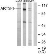 ARTS1 / ERAP1 Antibody - Western blot analysis of extracts from HepG2 cells, Jurkat cells and HUVEC cells, using ARTS-1 antibody.