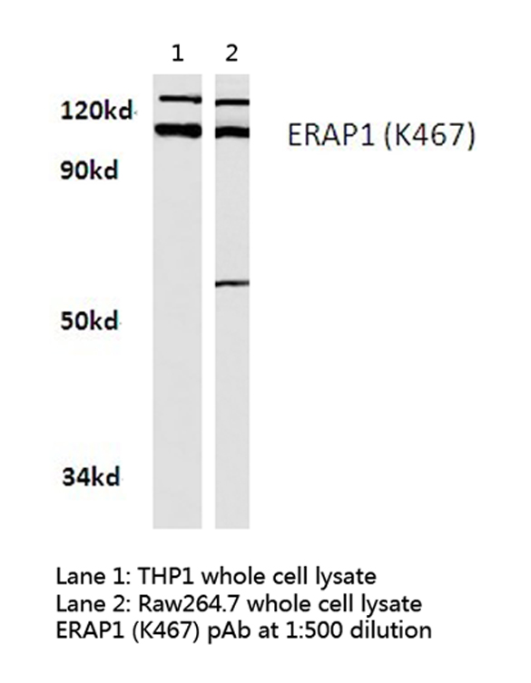 ARTS1 / ERAP1 Antibody - Western blot of ERAP1 (K467) pAb in extracts from THP1 and raw264.7 cells.