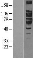 ARTS1 / ERAP1 Protein - Western validation with an anti-DDK antibody * L: Control HEK293 lysate R: Over-expression lysate