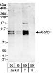 ARVCF Antibody - Detection of Human ARVCF by Western Blot. Samples: Whole cell lysate from Jurkat (15 and 50 ug), 293T (T; 50 ug) and HeLa (H; 50 ug) cells. Antibodies: Affinity purified rabbit anti-ARVCF antibody used for WB at 1 ug/ml. Detection: Chemiluminescence with an exposure time of 3 minutes.