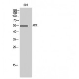 ARX Antibody - Western blot of ARX antibody