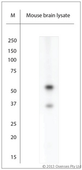 ARX Antibody - Rabbit antibody to ARX (2-50). WB on mouse brain lysate. Blocking with 1% LFDM for 30 min at RT; Primary antibody used at 1:1500 dilution incubated overnight at 4C.