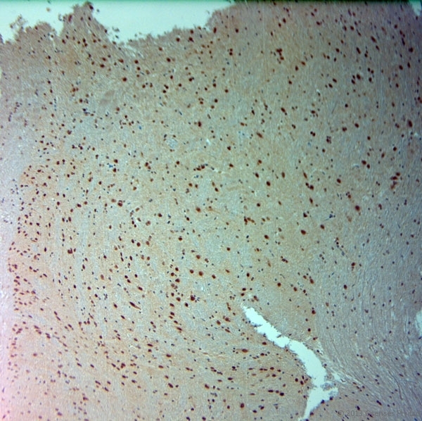 ARX Antibody - Rabbit antibody to ARX (2-50). IHC-P on paraffin sections of mouse spinal cord. The animal was perfused using Autoperfuser at a pressure of 110 mm Hg with 300 ml 4% FA and further post fixed overnight before being processed for paraffin embedding. HIER: Tris-EDTA, pH 9 for 20 min using Thermo PT Module. Blocking: 0.2% LFDM in TBST filtered through a 0.2 micron filter. Detection was done using Novolink HRP polymer from Leica following manufacturers instructions. Primary antibody: dilution 1:1000, incubated 30 min at RT using Autostainer. Sections were counterstained with Harris Hematoxylin.