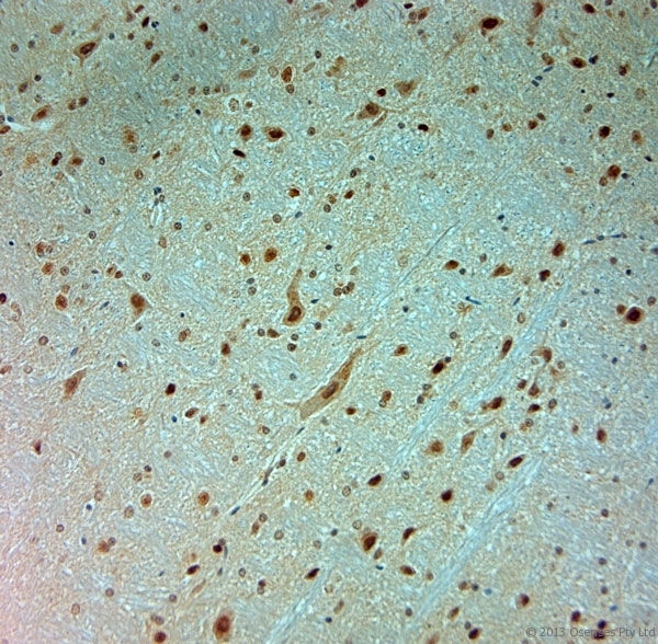 ARX Antibody - Rabbit antibody to ARX (2-50). IHC-P on paraffin sections of mouse spinal cord. The animal was perfused using Autoperfuser at a pressure of 110 mm Hg with 300 ml 4% FA and further post fixed overnight before being processed for paraffin embedding. HIER: Tris-EDTA, pH 9 for 20 min using Thermo PT Module. Blocking: 0.2% LFDM in TBST filtered through a 0.2 micron filter. Detection was done using Novolink HRP polymer from Leica following manufacturers instructions. Primary antibody: dilution 1:1000, incubated 30 min at RT using Autostainer. Sections were counterstained with Harris Hematoxylin.