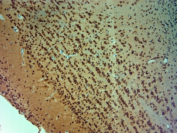 ARX Antibody - Rabbit antibody to ARX (2-50). IHC-P on paraffin sections of mouse olfactory bulb. The animal was perfused using Autoperfuser at a pressure of 110 mm Hg with 300 ml 4% FA and further post fixed overnight before being processed for paraffin embedding. HIER: Tris-EDTA, pH 9 for 20 min using Thermo PT Module. Blocking: 0.2% LFDM in TBST filtered through a 0.2 micron filter. Detection was done using Novolink HRP polymer from Leica following manufacturers instructions. Primary antibody: dilution 1:1000, incubated 30 min at RT using Autostainer. Sections were counterstained with Harris Hematoxylin.
