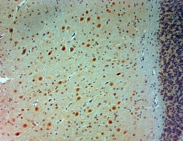ARX Antibody - Rabbit antibody to ARX (2-50). IHC-P on paraffin sections of mouse brain. The animal was perfused using Autoperfuser at a pressure of 110 mm Hg with 300 ml 4% FA and further post fixed overnight before being processed for paraffin embedding. HIER: Tris-EDTA, pH 9 for 20 min using Thermo PT Module. Blocking: 0.2% LFDM in TBST filtered through a 0.2 micron filter. Detection was done using Novolink HRP polymer from Leica following manufacturers instructions. Primary antibody: dilution 1:1000, incubated 30 min at RT using Autostainer. Sections were counterstained with Harris Hematoxylin.