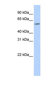 ARX Antibody - ARX antibody Western blot of HeLa lysate. This image was taken for the unconjugated form of this product. Other forms have not been tested.