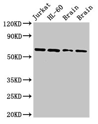 ARX Antibody - Positive Western Blot detected in Jurkat whole cell lysate, HL-60 whole cell lysate, Rat brain tissue, Mouse brain tissue. All lanes: ARX antibody at 2.7 µg/ml Secondary Goat polyclonal to rabbit IgG at 1/50000 dilution. Predicted band size: 59 KDa. Observed band size: 59 KDa