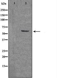 ARX Antibody - Western blot analysis of extracts of 293 cells using ARX antibody. The lane on the left is treated with the antigen-specific peptide.