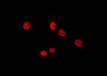 ARX Antibody - Staining HepG2 cells by IF/ICC. The samples were fixed with PFA and permeabilized in 0.1% Triton X-100, then blocked in 10% serum for 45 min at 25°C. The primary antibody was diluted at 1:200 and incubated with the sample for 1 hour at 37°C. An Alexa Fluor 594 conjugated goat anti-rabbit IgG (H+L) Ab, diluted at 1/600, was used as the secondary antibody.