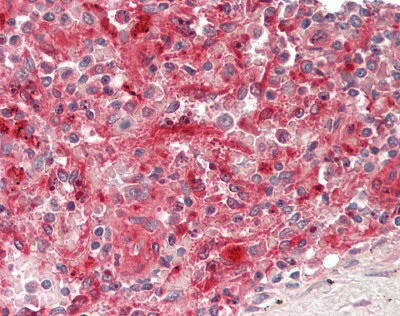 ASAH1 / Acid Ceramidase Antibody - Human Spleen: Formalin-Fixed, Paraffin-Embedded (FFPE).  This image was taken for the unconjugated form of this product. Other forms have not been tested.