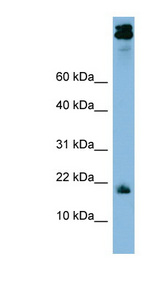 ASAH1 / Acid Ceramidase Antibody - ASAH1 antibody western blot of THP-1 cell lysate.  This image was taken for the unconjugated form of this product. Other forms have not been tested.