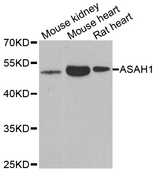ASAH1 / Acid Ceramidase Antibody - Western blot analysis of extracts of various cell lines.