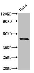 ASAH1 / Acid Ceramidase Antibody - Western Blot Positive WB detected in:Hela whole cell lysate All Lanes:ASAH1 antibody at 3µg/ml Secondary Goat polyclonal to rabbit IgG at 1/50000 dilution Predicted band size: 45,47 KDa Observed band size: 45 KDa