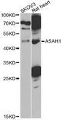 ASAH1 / Acid Ceramidase Antibody - Western blot analysis of extracts of various cell lines, using ASAH1 antibody at 1:1000 dilution. The secondary antibody used was an HRP Goat Anti-Rabbit IgG (H+L) at 1:10000 dilution. Lysates were loaded 25ug per lane and 3% nonfat dry milk in TBST was used for blocking. An ECL Kit was used for detection and the exposure time was 90s.