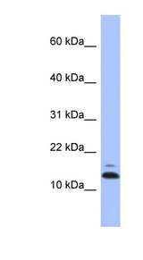 ASAH1 / Acid Ceramidase Antibody - ASAH1 antibody western blot of Human fetal lung lysate.  This image was taken for the unconjugated form of this product. Other forms have not been tested.