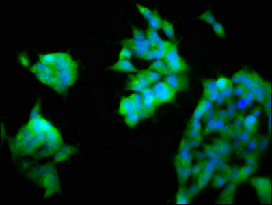 ASAH2 Antibody - Immunofluorescence staining of 293 cells with ASAH2 Antibody at 1:200, counter-stained with DAPI. The cells were fixed in 4% formaldehyde, permeabilized using 0.2% Triton X-100 and blocked in 10% normal Goat Serum. The cells were then incubated with the antibody overnight at 4°C. The secondary antibody was Alexa Fluor 488-congugated AffiniPure Goat Anti-Rabbit IgG(H+L).