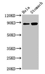 ASAH2 Antibody - Western Blot Positive WB detected in: Hela whole cell lysate, Rat stomach tissue All lanes: ASAH2 antibody at 3µg/ml Secondary Goat polyclonal to rabbit IgG at 1/50000 dilution Predicted band size: 86, 82 kDa Observed band size: 86 kDa