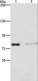 ASAH2 Antibody - Western blot analysis of Human fetal kidney tissue and 293T cell, using ASAH2 Polyclonal Antibody at dilution of 1:240.