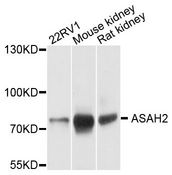 ASAH2 Antibody - Western blot analysis of extracts of various cell lines, using ASAH2 antibody at 1:1000 dilution. The secondary antibody used was an HRP Goat Anti-Rabbit IgG (H+L) at 1:10000 dilution. Lysates were loaded 25ug per lane and 3% nonfat dry milk in TBST was used for blocking. An ECL Kit was used for detection and the exposure time was 1s.