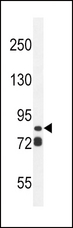 ASAP3 Antibody - ASAP3 Antibody western blot of ZR-75-1 cell line lysates (35 ug/lane). The ASAP3 antibody detected the ASAP3 protein (arrow).