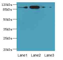 ASAP3 Antibody - Western blot. All lanes: ASAP3 antibody at 1 ug/ml. Lane 1: A549 whole cell lysate. Lane 2: MCF7 whole cell lysate. Lane 3: K562 whole cell lysate. Secondary Goat polyclonal to Rabbit IgG at 1:10000 dilution. Predicted band size: 99 kDa. Observed band size: 99 kDa.