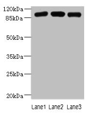 ASAP3 Antibody - Western blot All lanes: ASAP3 antibody at 1µg/ml Lane 1: A549 whole cell lysate Lane 2: MCF-7 whole cell lysate Lane 3: K562 whole cell lysate Secondary Goat polyclonal to rabbit IgG at 1/10000 dilution Predicted band size: 100, 44, 98 kDa Observed band size: 100 kDa