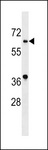 ASB10 Antibody - ASB10 Antibody western blot of K562 cell line lysates (35 ug/lane). The ASB10 antibody detected the ASB10 protein (arrow).