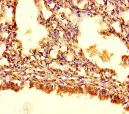 ASB10 Antibody - Immunohistochemistry of paraffin-embedded human lung tissue using ASB10 Antibody at dilution of 1:100