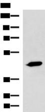 ASB10 Antibody - Western blot analysis of A431 cell lysate  using ASB10 Polyclonal Antibody at dilution of 1:800