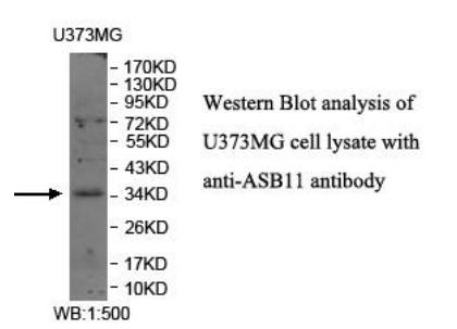 ASB11 Antibody - Western blot of ASB11 antibody
