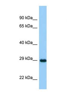 ASB11 Antibody - ASB11 antibody Western blot of Rat Muscle lysate. Antibody concentration 1 ug/ml.  This image was taken for the unconjugated form of this product. Other forms have not been tested.